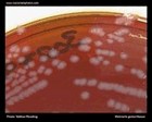 Neisseria gonorrhoeae on New York City medium